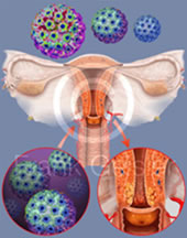 hpv tiplemesi nedir)